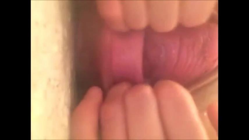 Amateur girl stretching big cervix and prolapse ass closeup